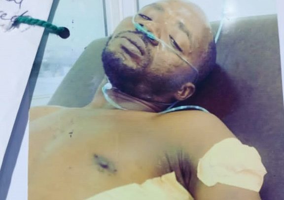 Man stabbed in rib and shoulder after allegedly gossiping about suspect