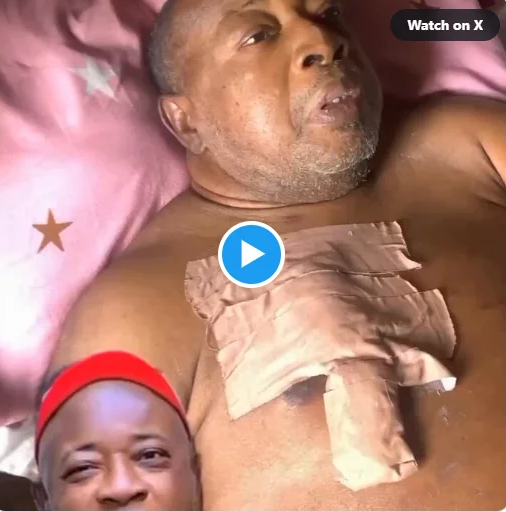 Veteran actor Amaechi Muonagor battles with kidney problems