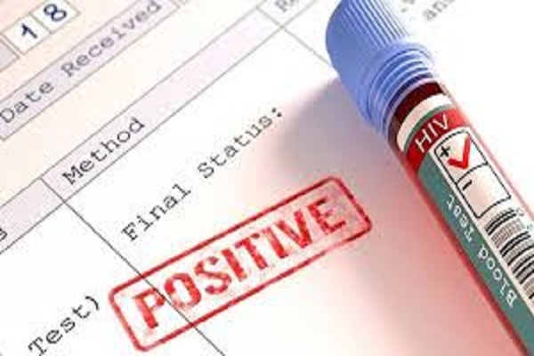 Ghana’s new HIV cases recorded surges by 7%