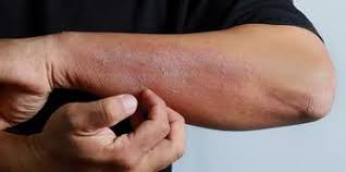 Four early signs of skin cancer you need to Know