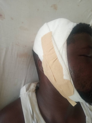 Man beaten to a pulp for reportedly stealing man’s genitals at Senya Bereku