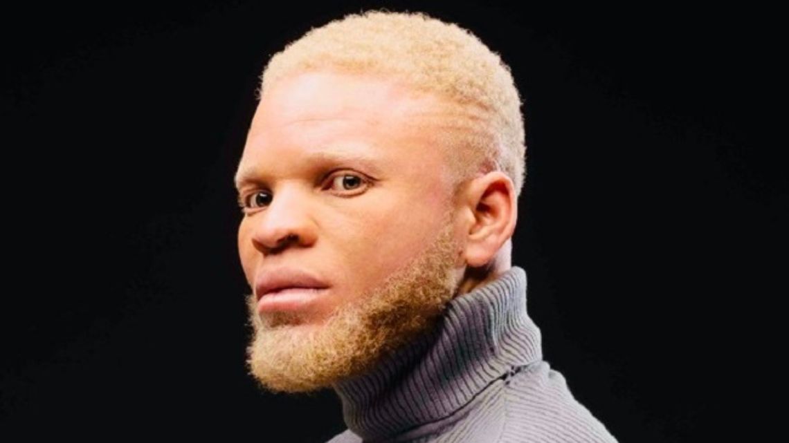 I was abandoned by my father at birth due to my albinism- 2023 Mentor winner Byno