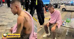 Malaysian player Halim can walk again after 3rd surgery following acid attack
