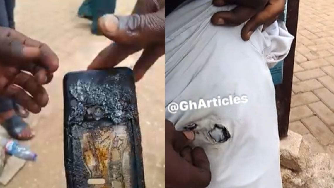 Alleged fake Huawei phone burns while in man’s pocket, netizens react