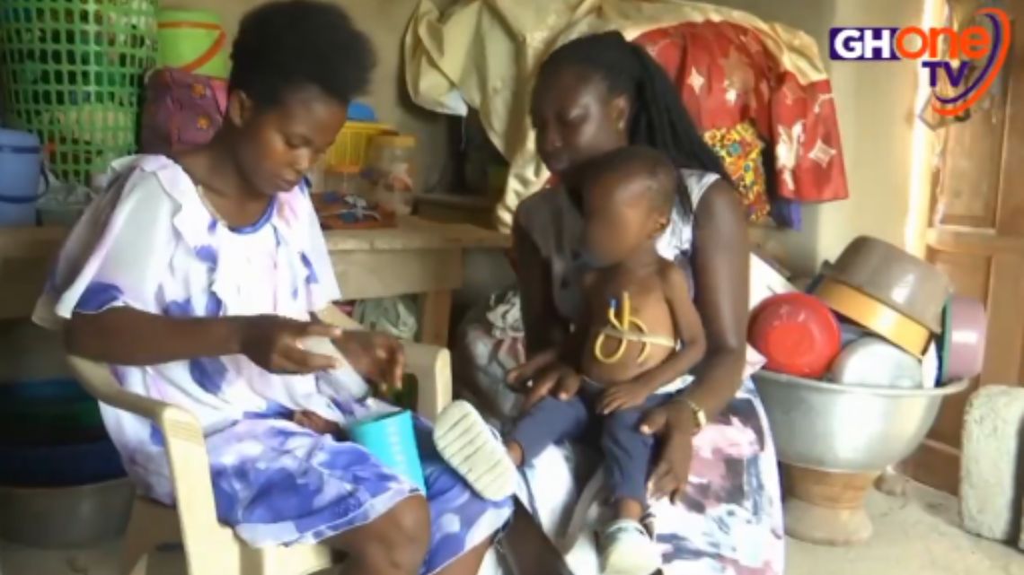 Toddler in need of GHC400K to undergo oesophageal stricture surgery