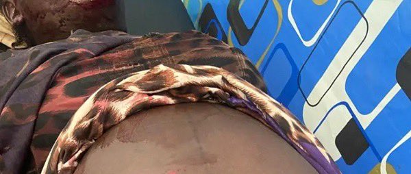 Man brutally ‘slashes’ 7-months-pregnant wife with machete in Oti Region