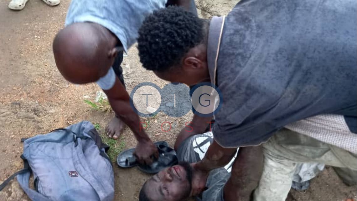 Poor young man battles for his life after father and son beat and broke his legs