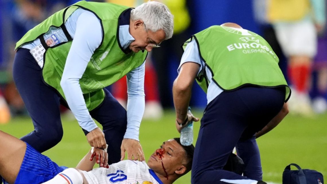 Euro 2024: Mbappe suffers severe nose bleeding after colliding with Austria’s Kevin Danso