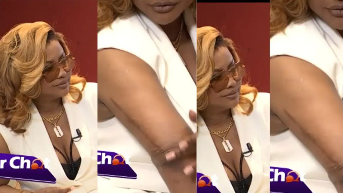 I’ve undergone four surgeries on my right arm – McBrown