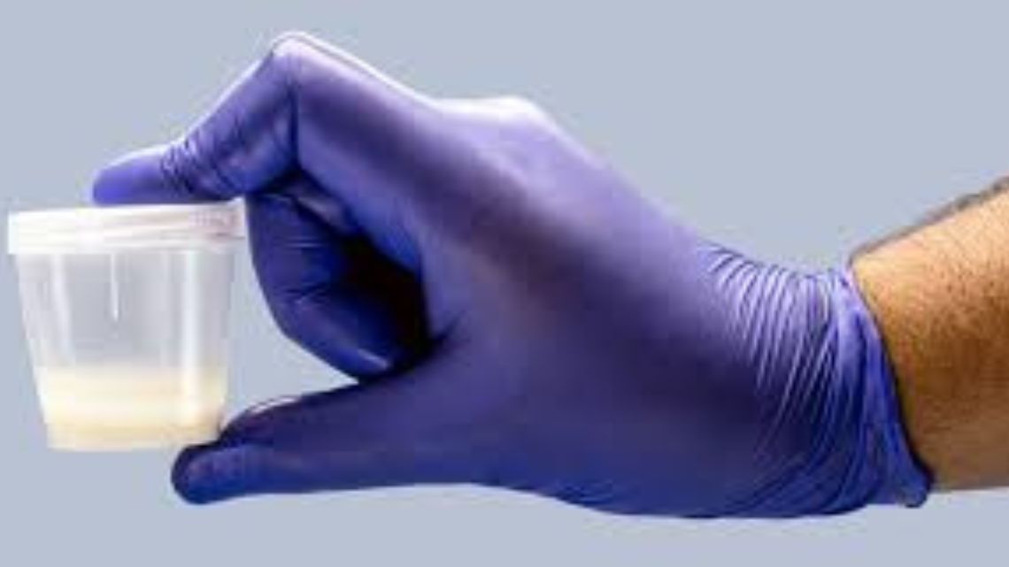 Ghanaian students on gov’t scholarship abroad survive by selling their sperms for £150-£250 – PhD student