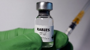Rabies kills 26 people within 7 months this year – Veterinary Department