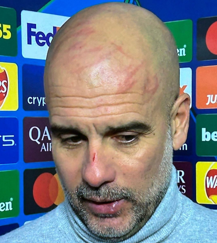 ‘I want to harm myself’, Guardiola says and jets off