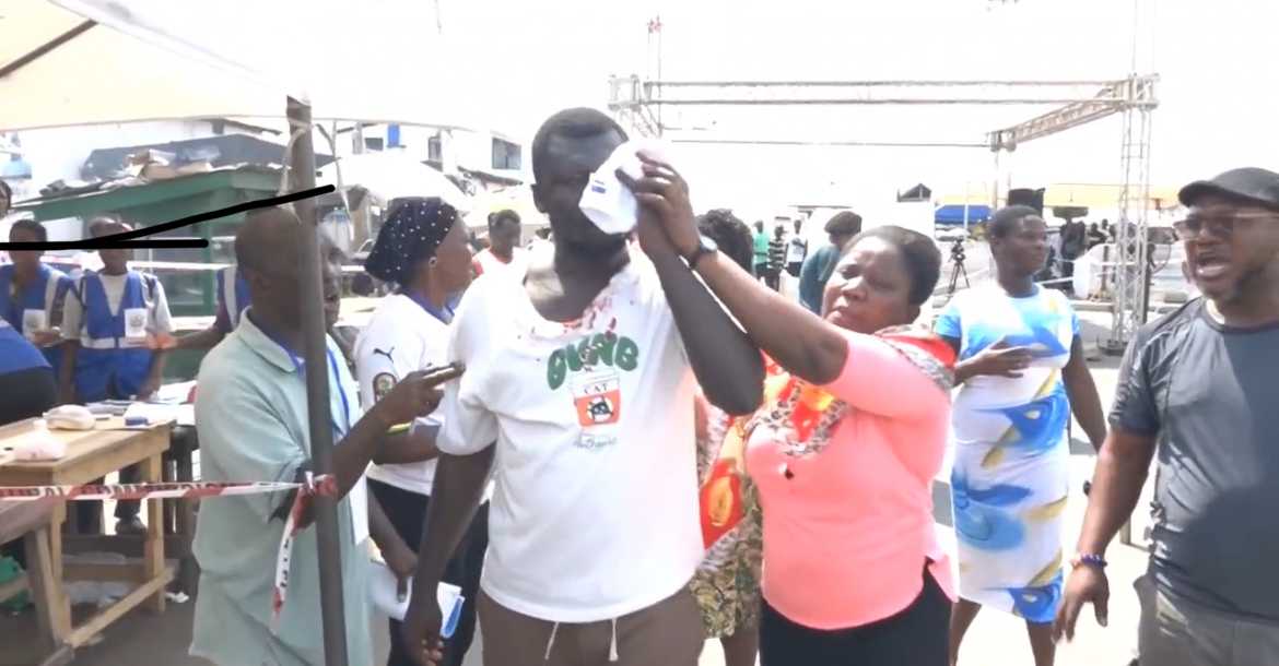 Electorate sustains head injury at Odododiodio constituency