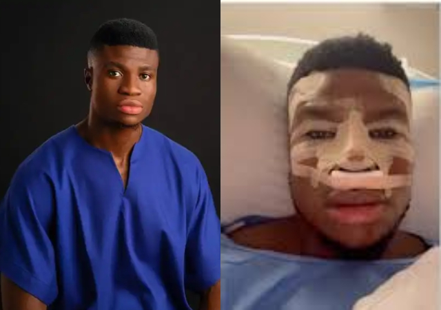 Comedian Zicsaloma says he didn’t pay for his nose surgery though it wasn’t free