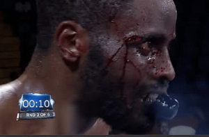 Video: See how Azumah Nelson’s son Delvin suffered a heavy defeat after in a boxing bout