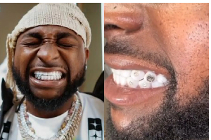 Davido flaunts his $500K diamond teeth,chain worth $2m