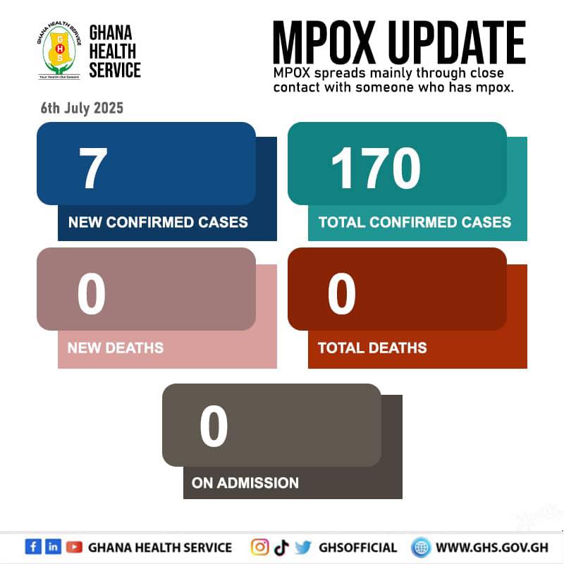 Ghana’s Mpox cases hit 170