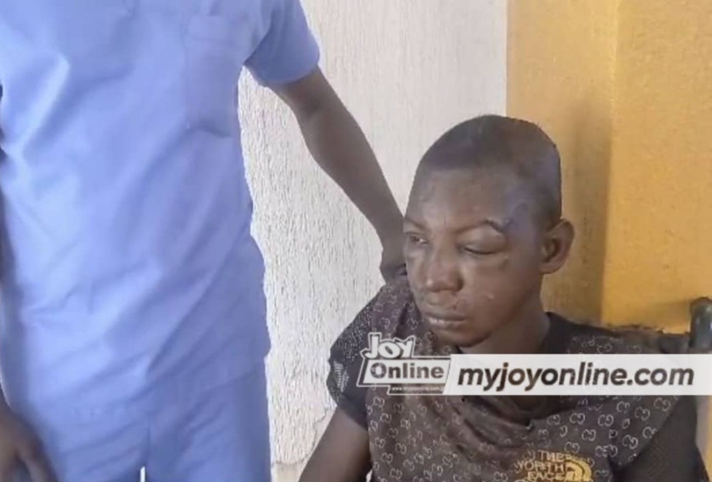Walewale Hospital discharges assault victim as family fails to reach him