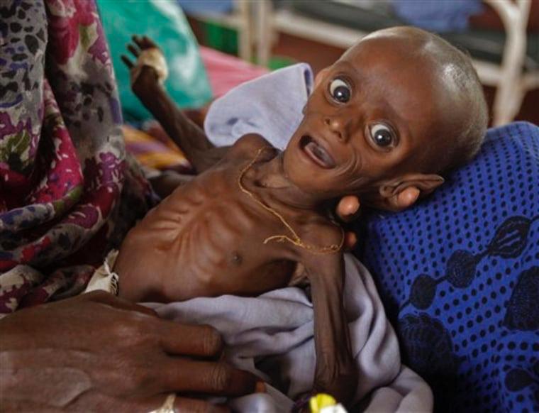 Rising child malnutrition in Nkwanta: An Outreach of Hope for restoration