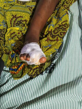 Police arrest woman for allegedly cutting daughter’s toe over her late return home