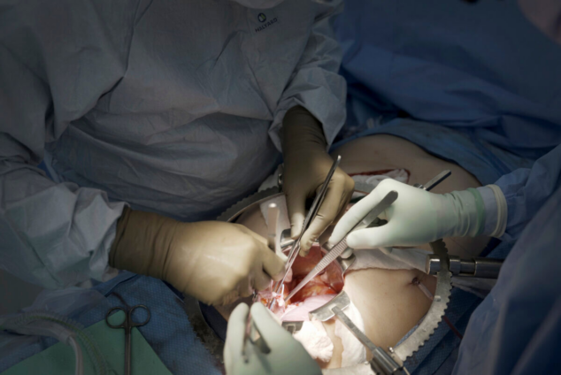 Chronic kidney disease cases rising across Ghana – Experts warn